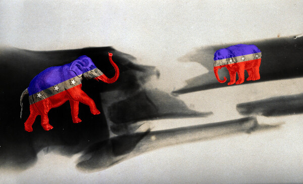 An X-ray of a broken femur. On either side of the fracture is a elephant (cropped from a medieval illumination) facing one another, in the livery of the GOP logo.